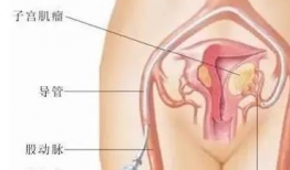 插入子宫漫画,探索生命起源的奇幻旅程